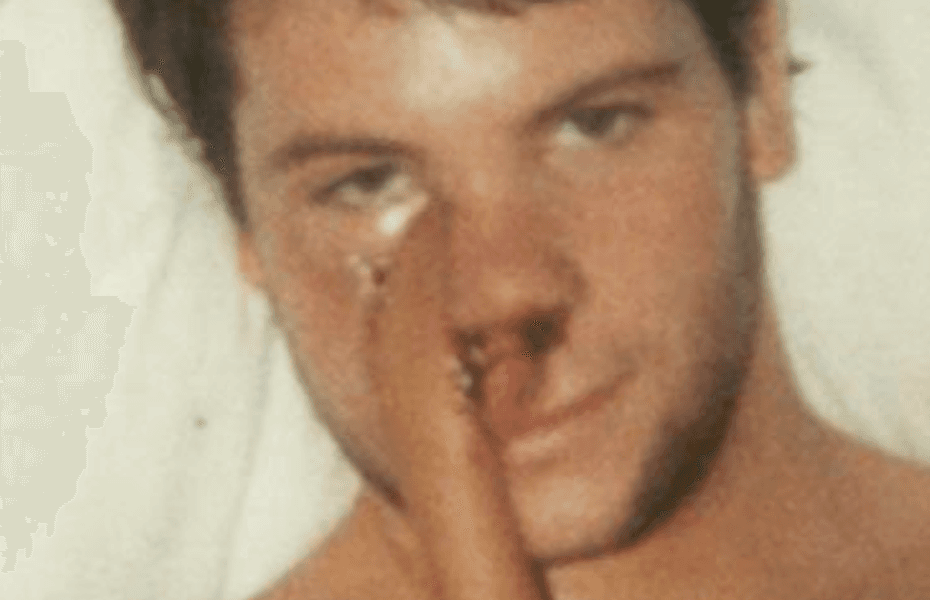 Cancer Survivor's Journey: From Disfigurement to Resilience